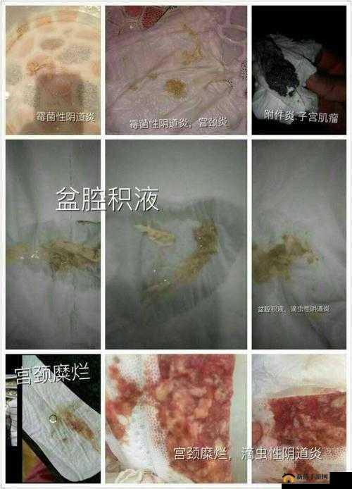老中医李雪妮：排阴毒，是真是假？