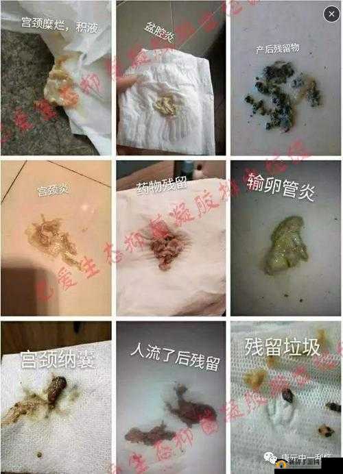 排阴毒：顶级村医的神奇医术