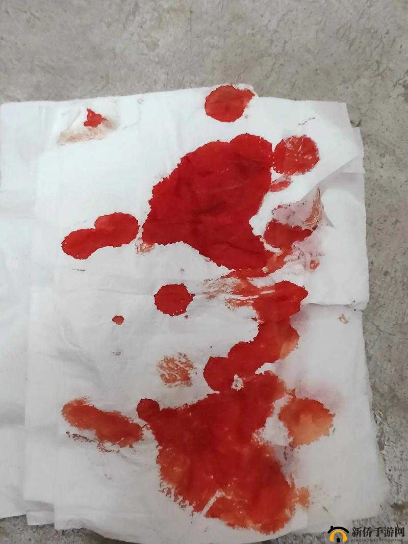 第一次做完后第二天有点出血，需警惕异常状况