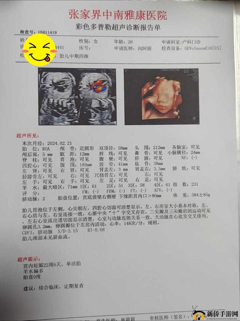 做彩超时医生总问做四维没有这究竟是何原因呢