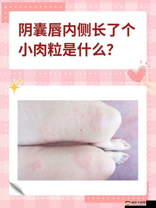 睾丸进入子宫的里面长肉粒是否正常：可能的原因及应对建议