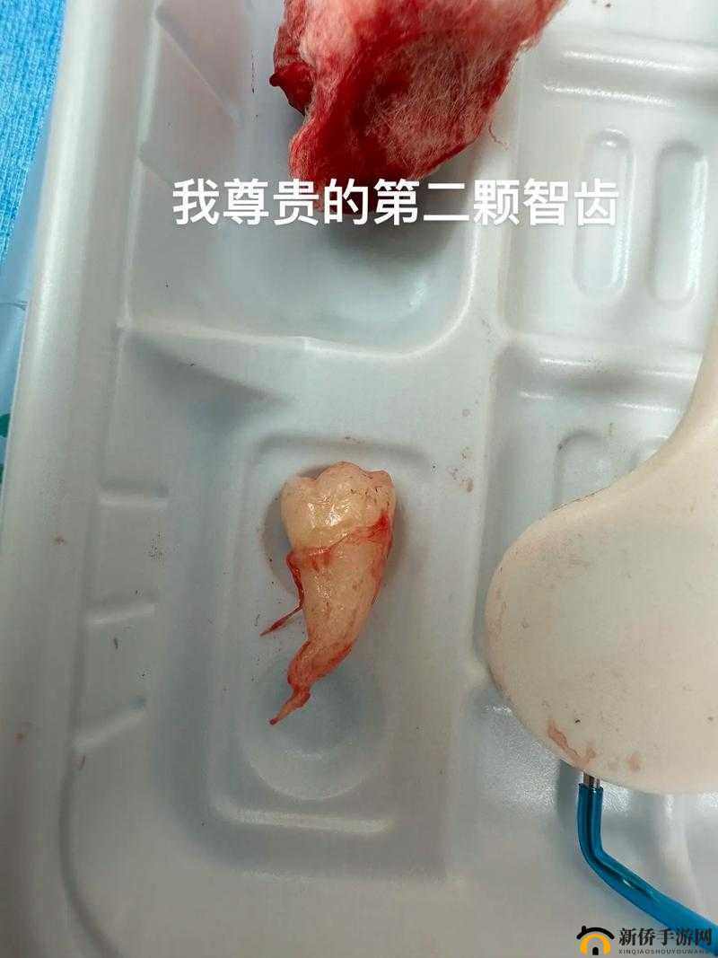太深拔出来痛太舒服：一段令人纠结的特殊体验