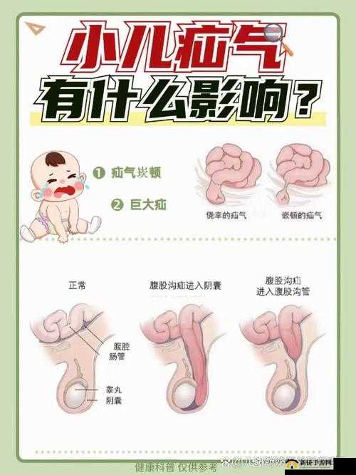 宝宝都湿透了还嘴硬疼：是生理问题还是心理原因？